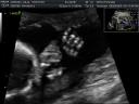 Little Hands